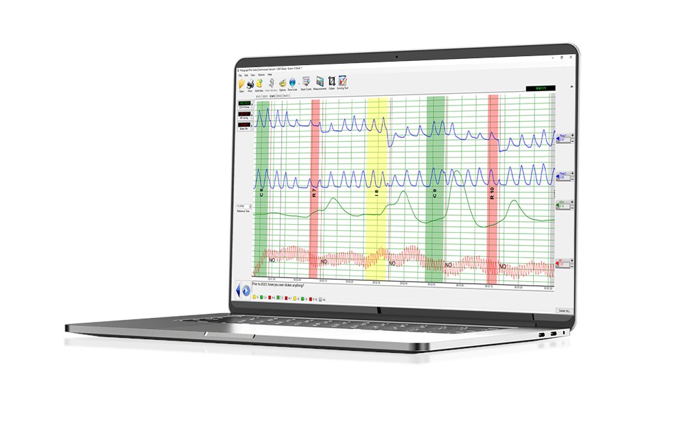 Bart Winchester banner