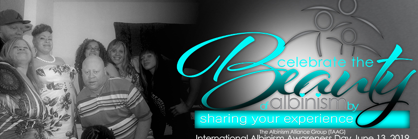 Albinism Alliance banner