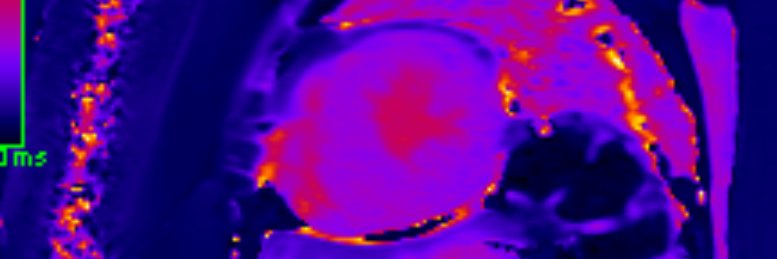 MSH Advanced CV Imaging Fellowship's banner