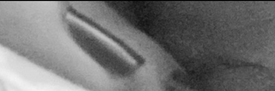 NG banner