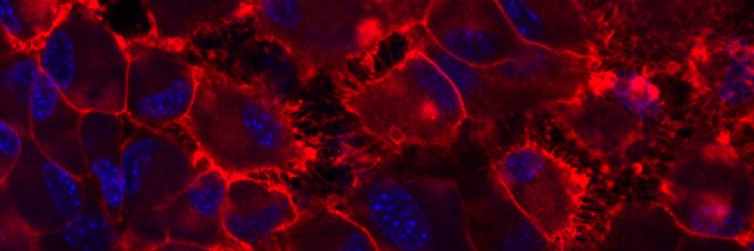 William Thompson banner