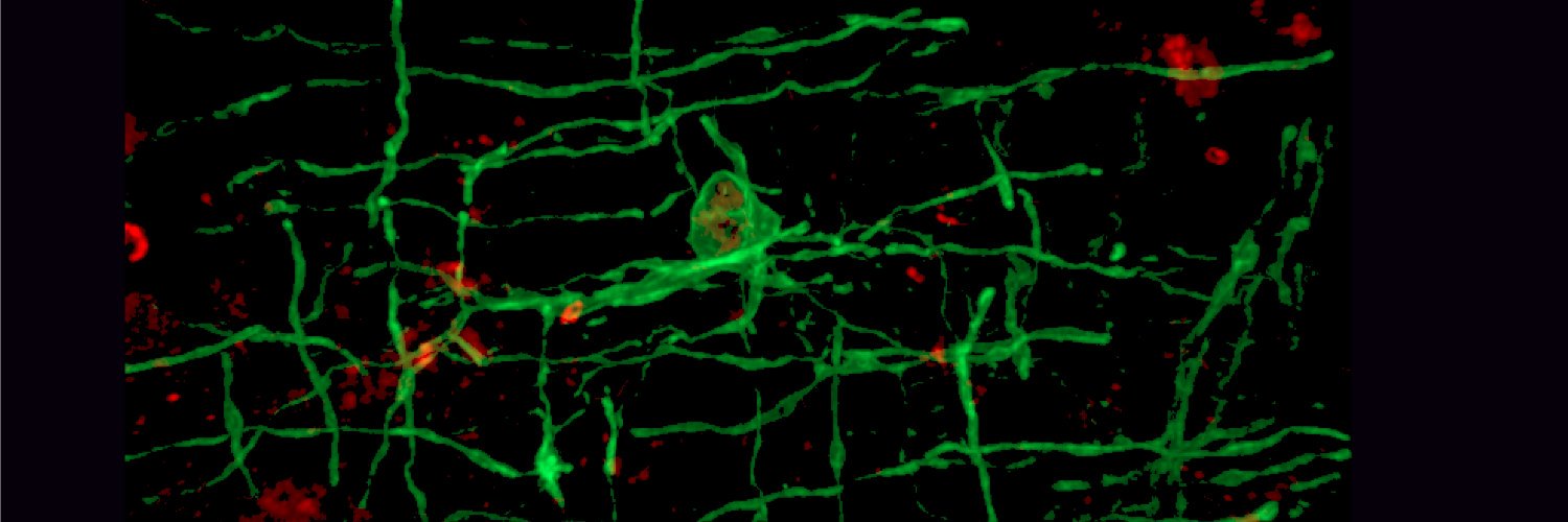 Peggy Assinck, PhD🔬🧠🇨🇦 🇬🇧 ♿️ banner