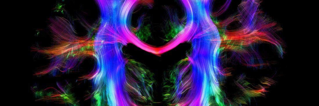 Alfred Anwander @AlfredAnwander.bsky.social banner