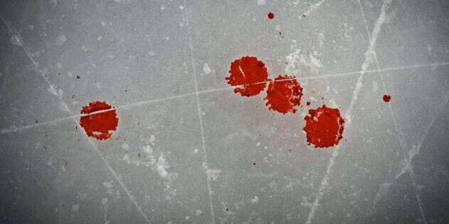 Pucks & Stitches banner