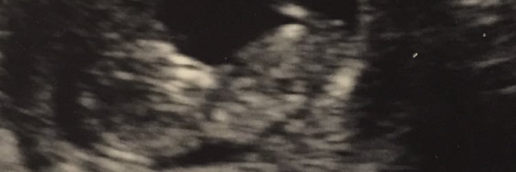 NewlywedMess's profile banner image