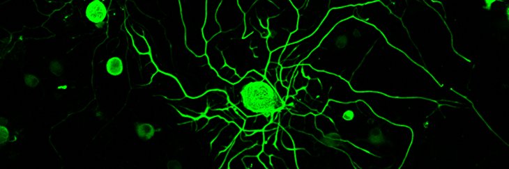 Ankush Chandra, MD, MS banner