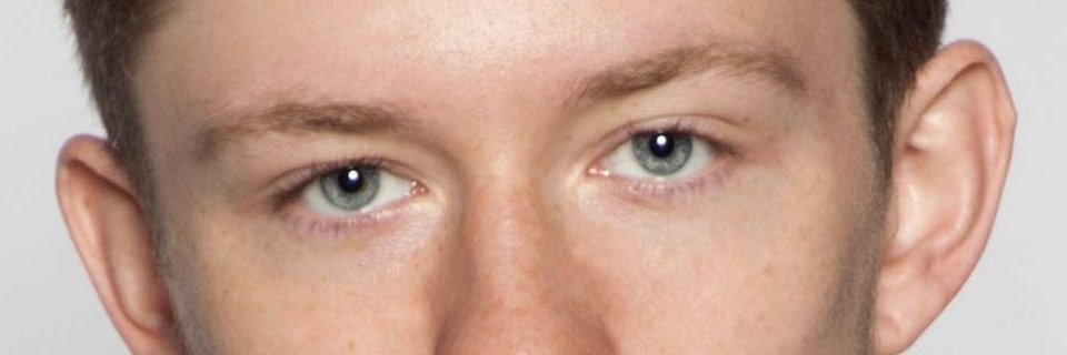 🅰️KFutoshi💯 Scrotal Bleeding. 陰嚢出血 banner