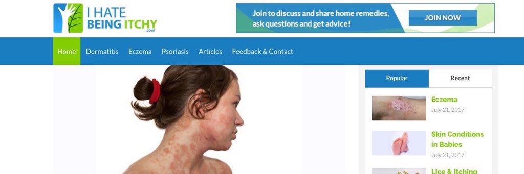 IhateBeingItchy's profile banner image