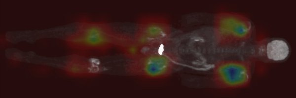 rheum_ai Profile Banner