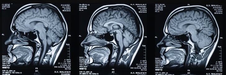 محمد الغامدي banner