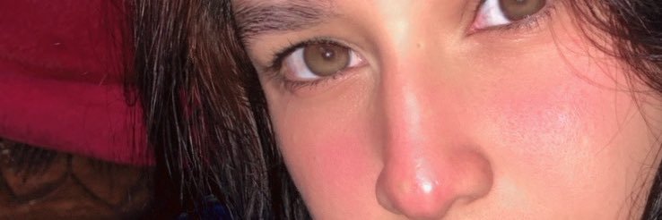 MYRC∞ & + → banner