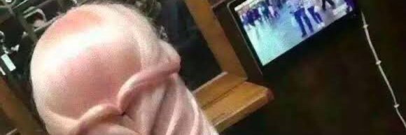 o tan (MDM planning) banner