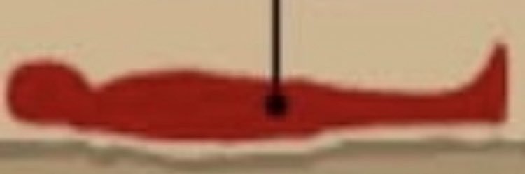 Fracking Extremist banner