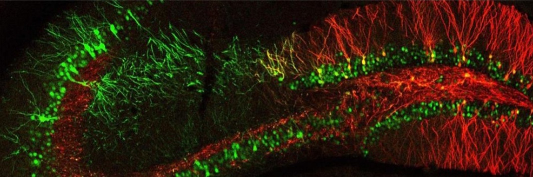 Upstate_Neuroscience banner