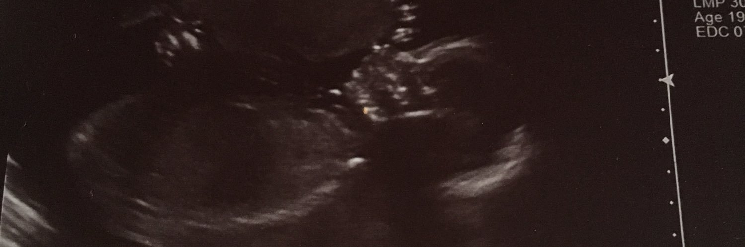 bex71xx's profile banner image