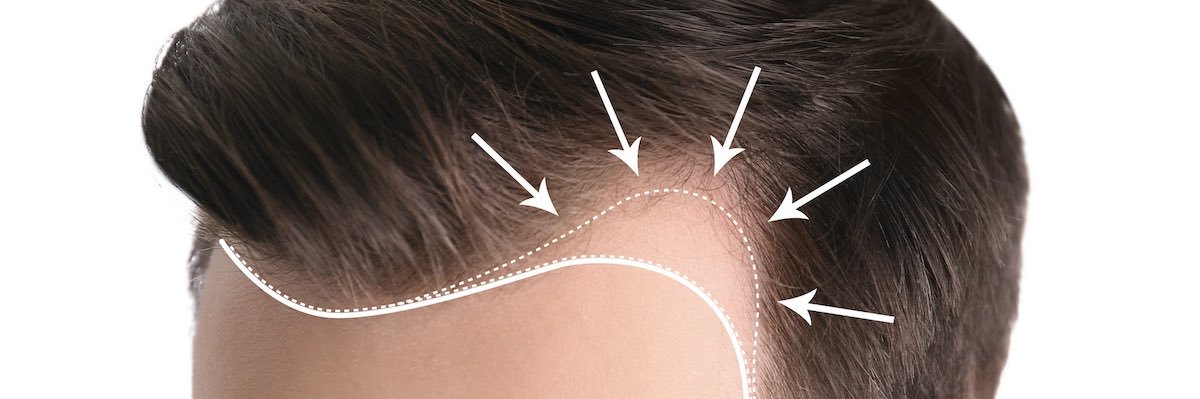 ross (space pilled) banner