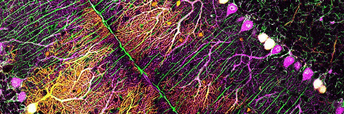 Alex Springall banner