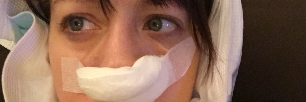 swallowed 2 contact lenses banner