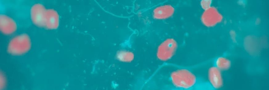 Mikrobio Itsastarrak Ikerketa Taldea banner