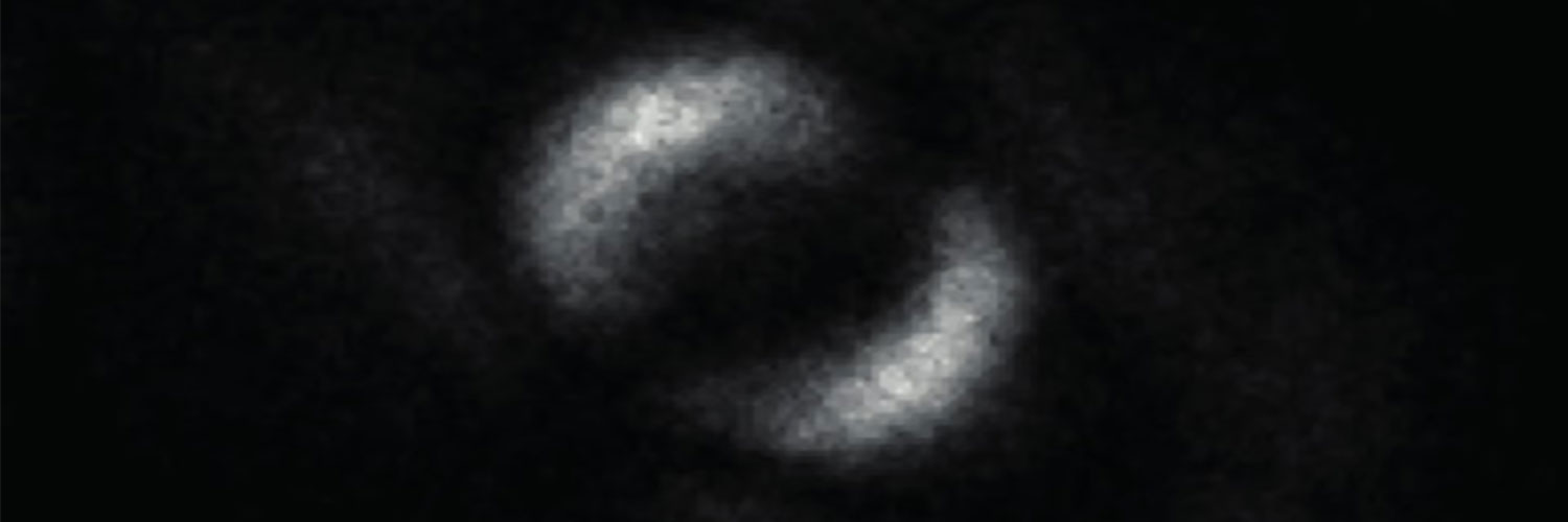 sdk banner