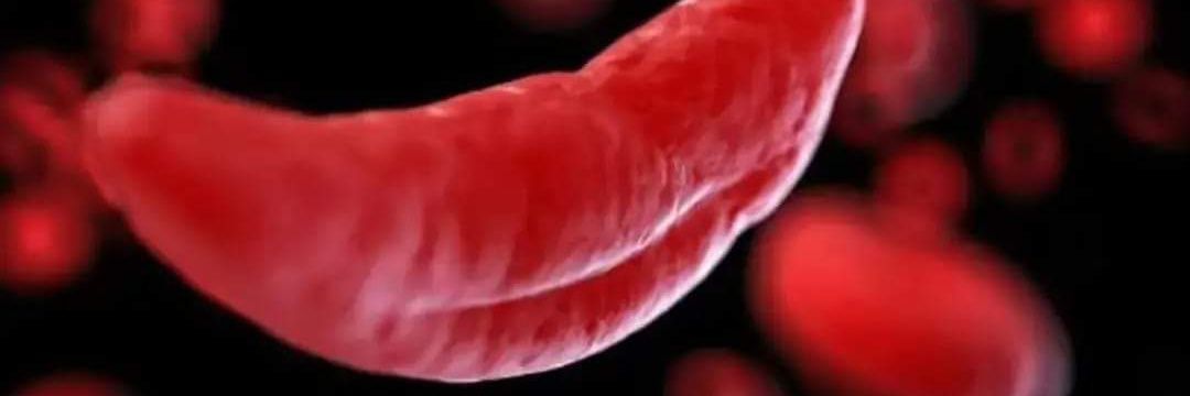 Sickle Cell Disease Club of Gulu University. banner