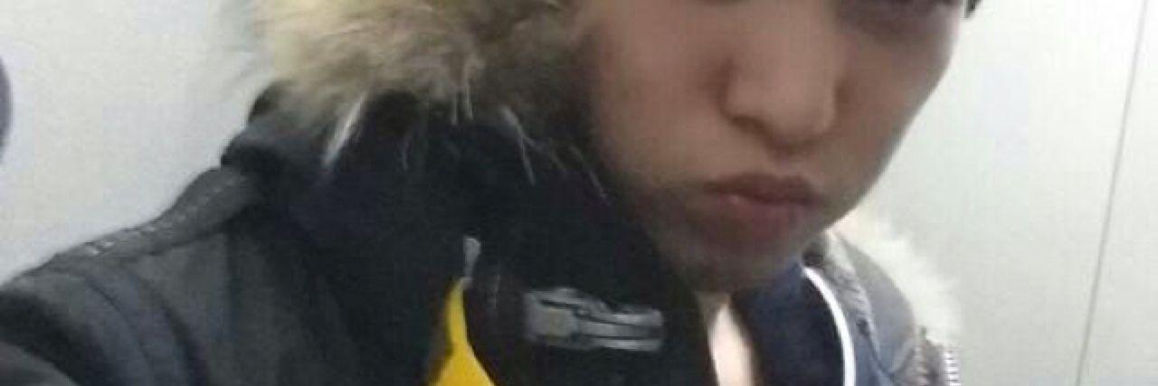 แอมติส banner