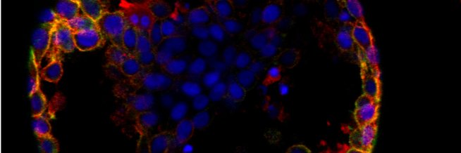 PROSTAMET_MSCA banner