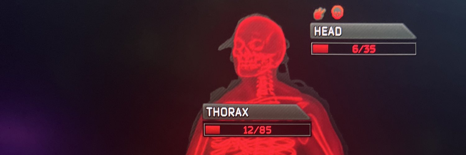 Tyrone - TF Toxicz (@Tyronedegod_) / Posts / X