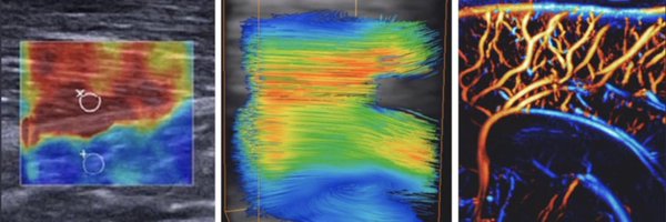 TanterM Profile Banner
