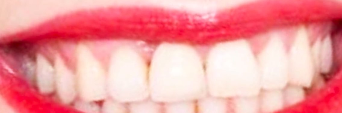S banner