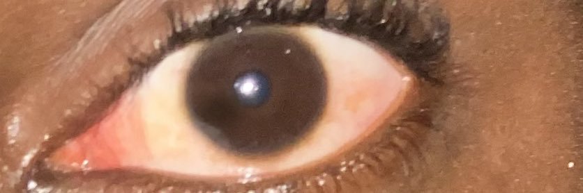 THE WATCHER👑👁️ banner