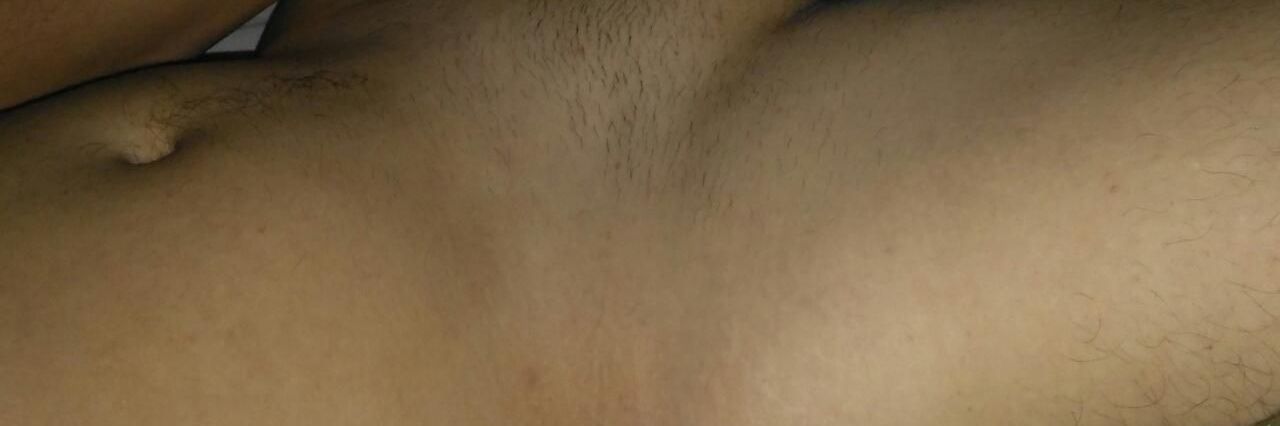 X banner
