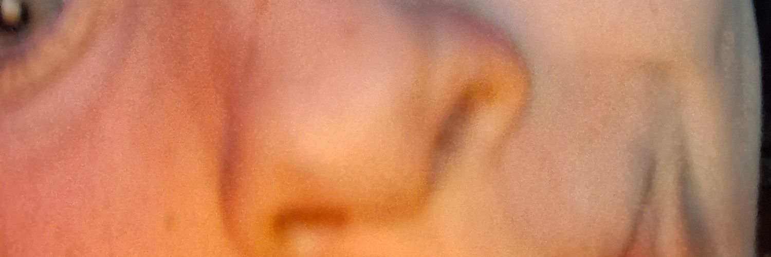 Blaze:Philippe banner