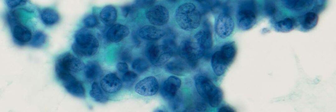 Mark CC Chen, M.D. FIAC banner