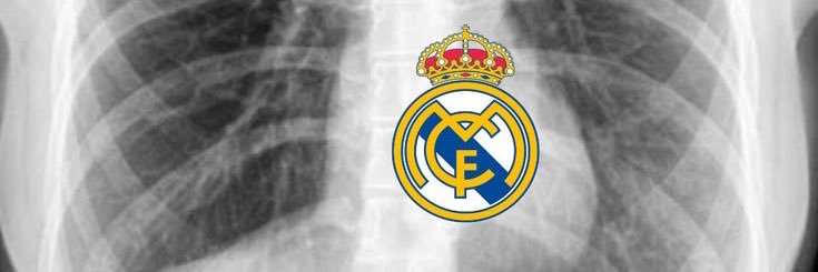 v banner