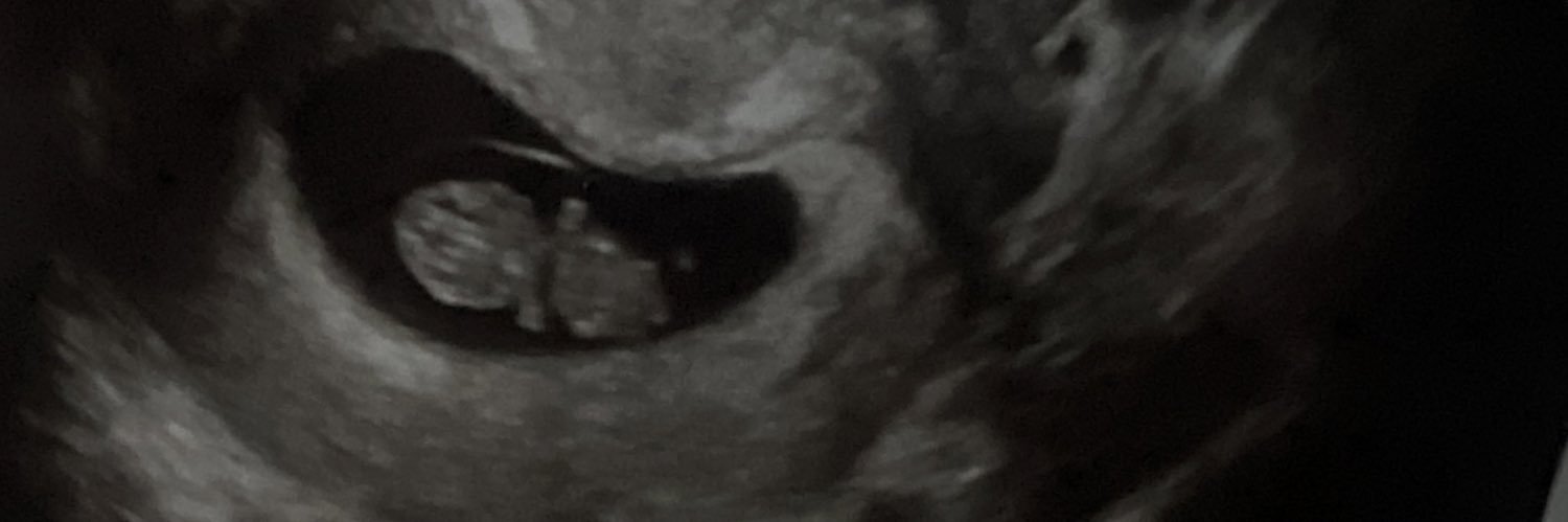 Cornage's profile banner image