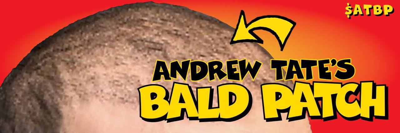 AndrewTatesBaldPatch banner