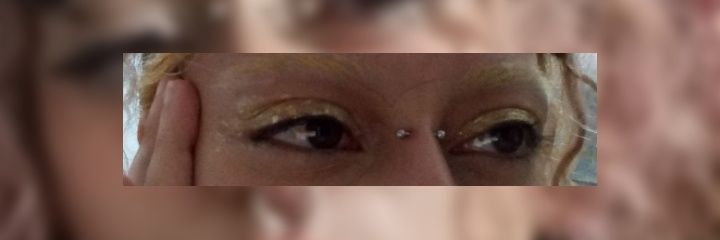 orelhas vagante vagal banner
