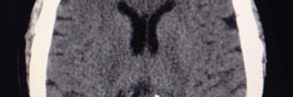 BrainProyectMD's profile banner image