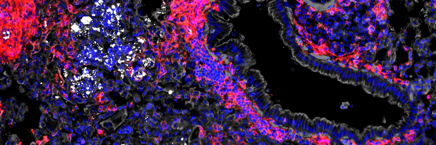 Arnaud Machelart banner