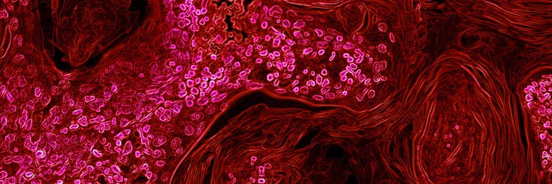 Pathological Society UG Network banner