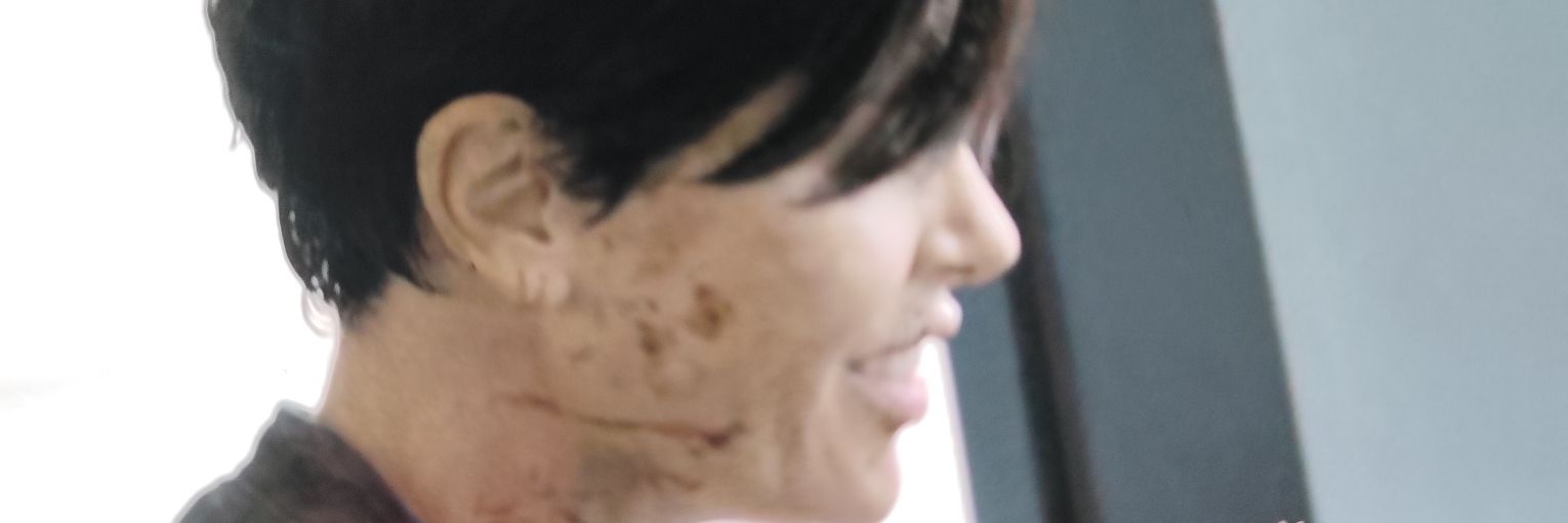 x banner