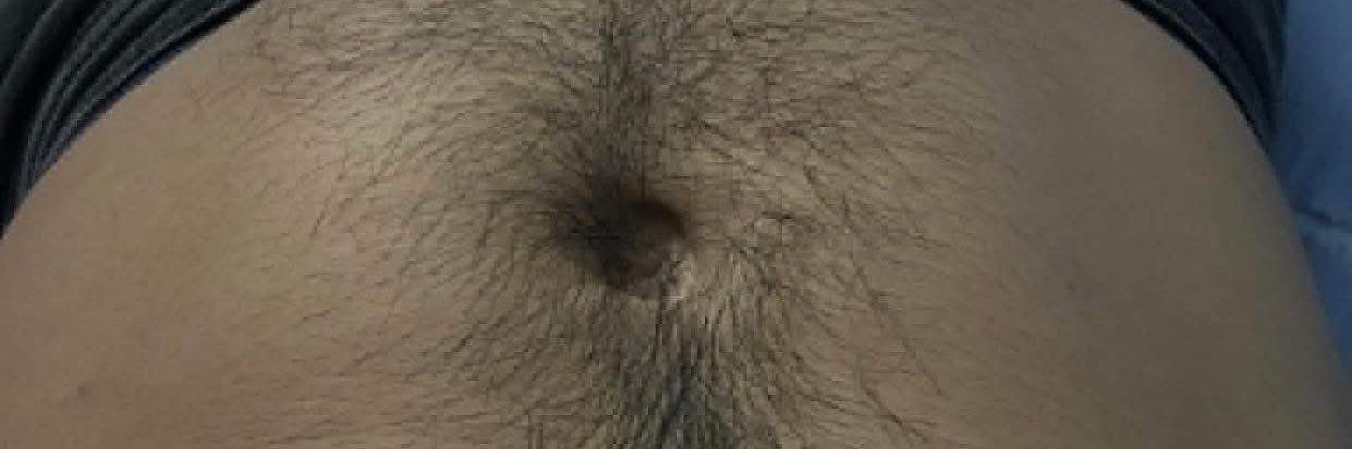 កំដរ សិច banner