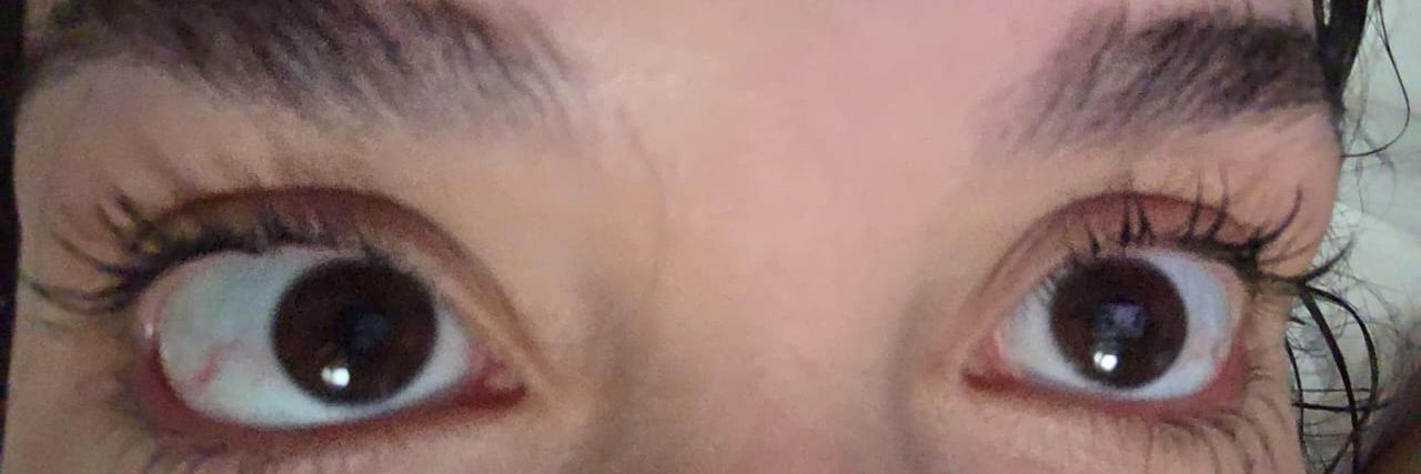 Mal Rubronegro banner