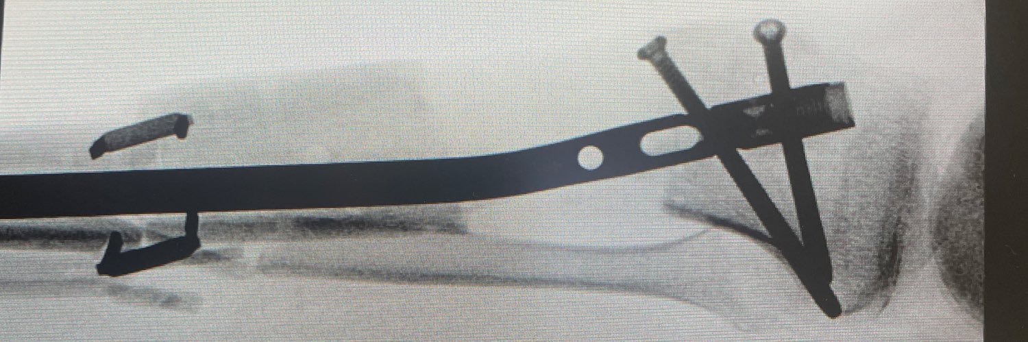 Joseph T. Patterson MD FACS FAAOS banner