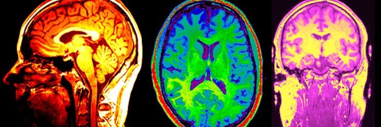 ICNeuroSoc's profile banner image