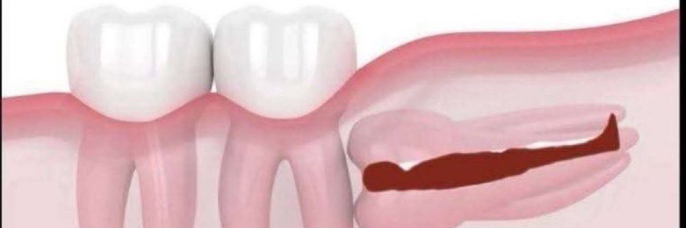 poo💢(kyuzizi) banner