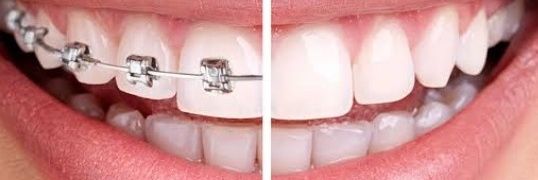 Snow dentalcare Clinic's banner