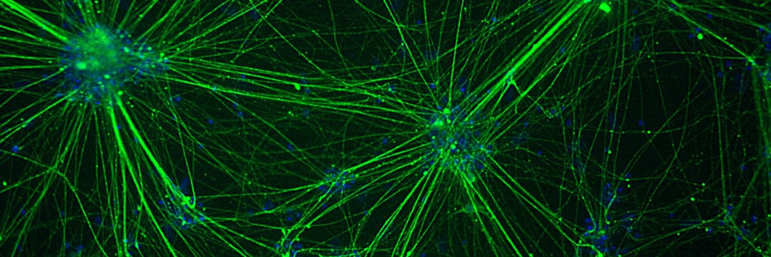 Tore B. Stage banner