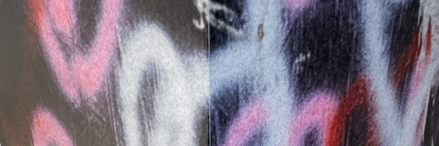 힛! banner